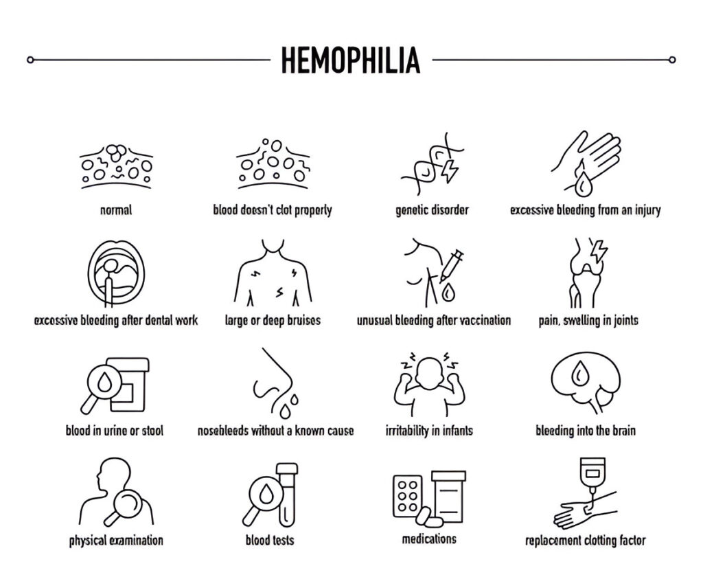 hemophilia-symptoms