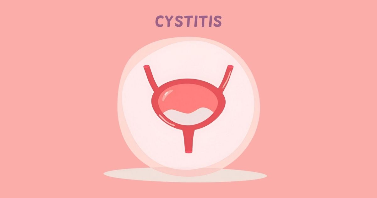 सिस्टाइटिस (Cystitis)