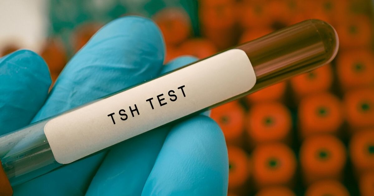 thyroid-stimulating-hormone-tsh-test